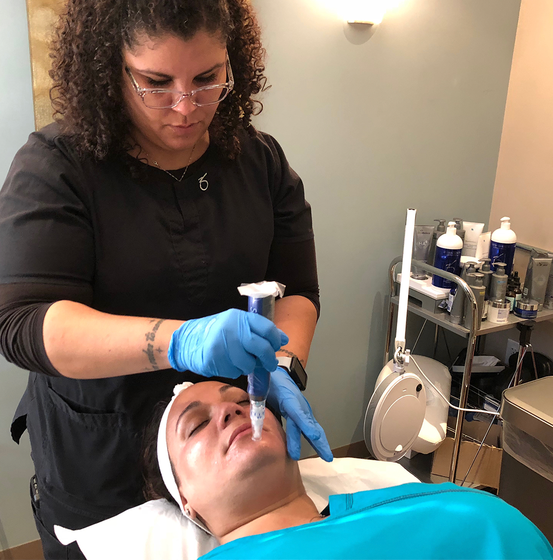 Patient for Lake Nona Ophthalmology receives a Plump and Smooth Microneedling Treatment 